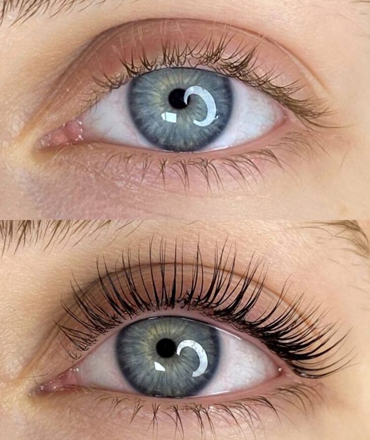 Kirpik-Lifting-Istanbul-3-scaled